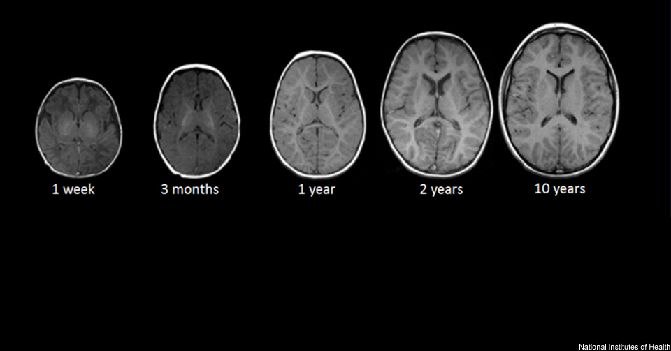 The deterministic myth of the ‘early years’