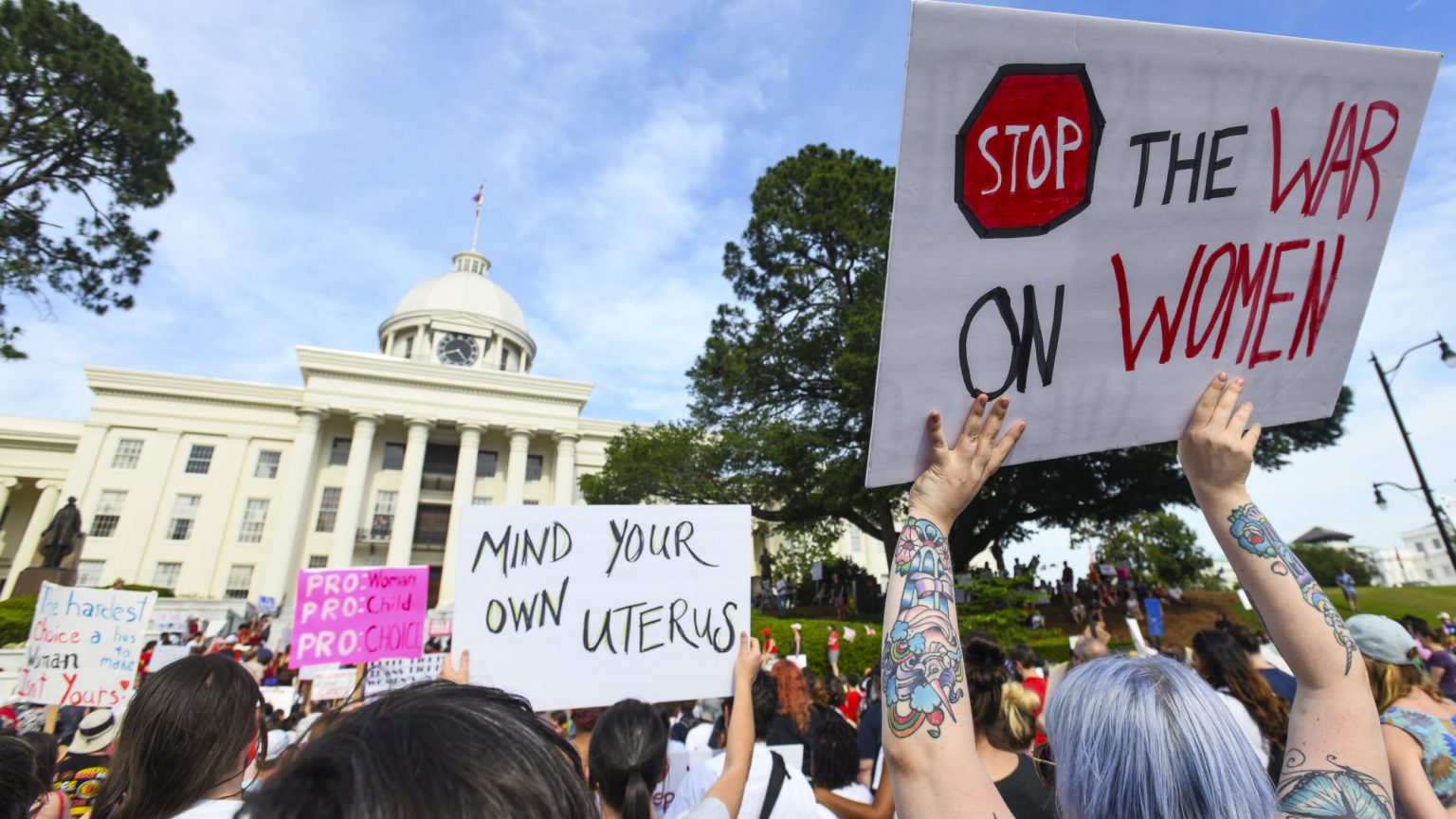 The fight for abortion rights is bigger than Alabama