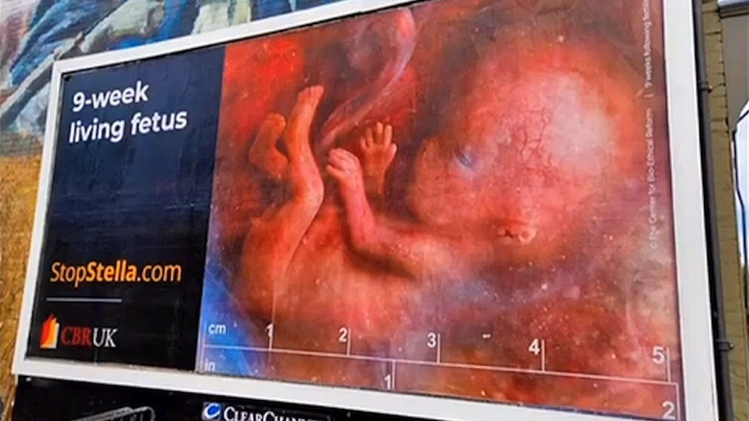 Anti-abortion posters are not ‘harassment’