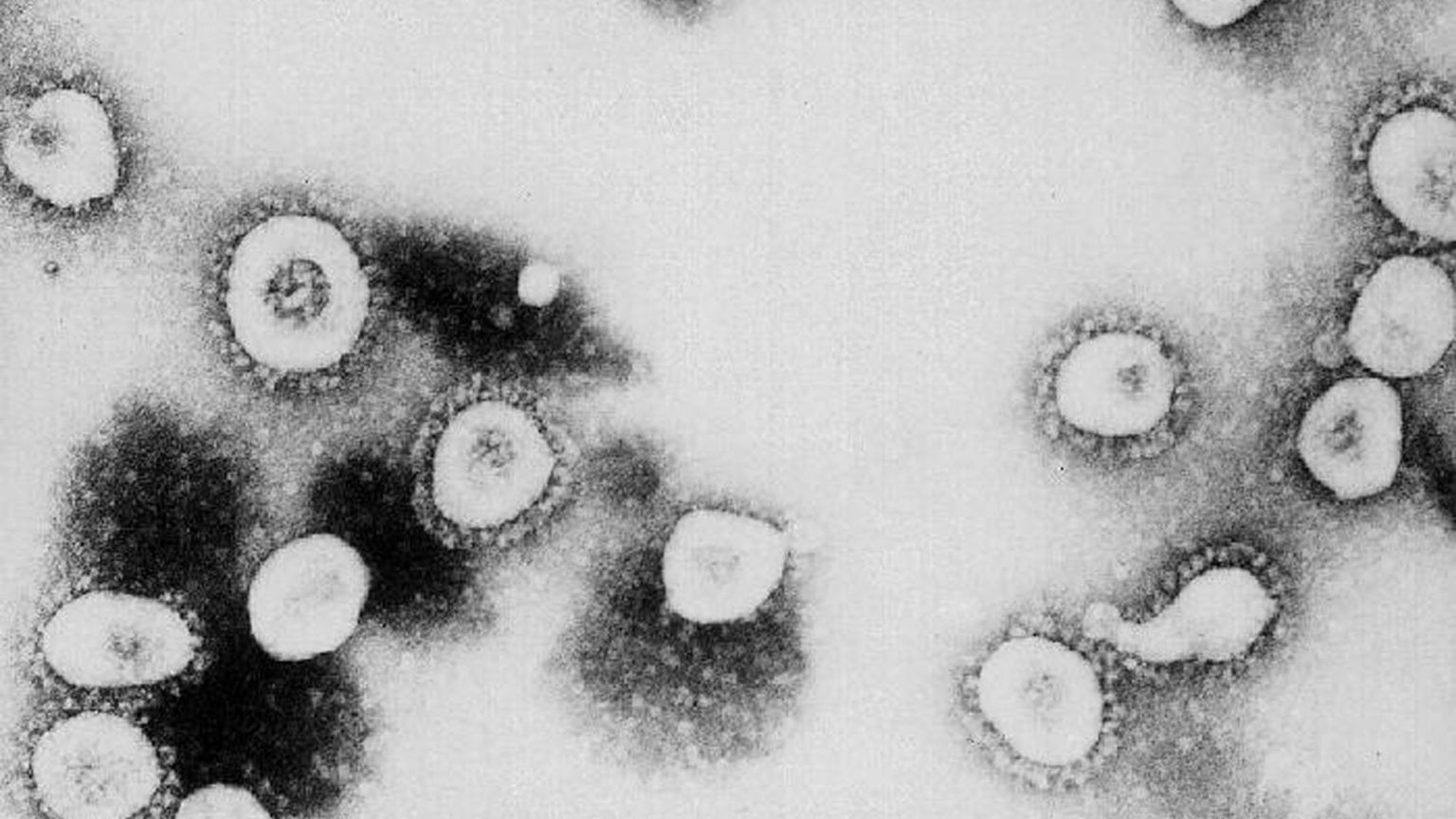 Can you self-identify as a coronavirus expert?