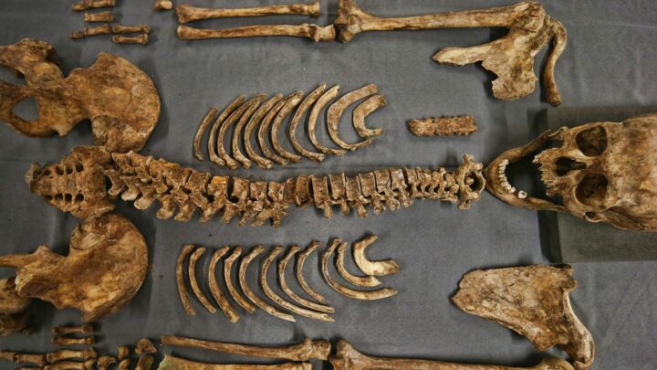 There’s no such thing as a nonbinary skeleton